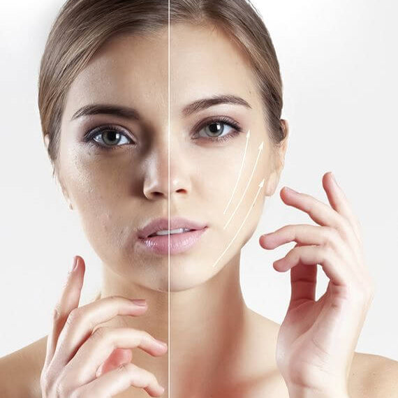 Before and after comparison of a woman's face with skincare effects.